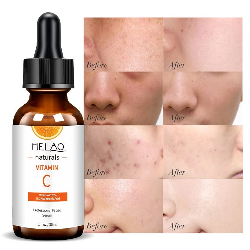 Vitamin C & Hyaluronic Face Serum (30ml)