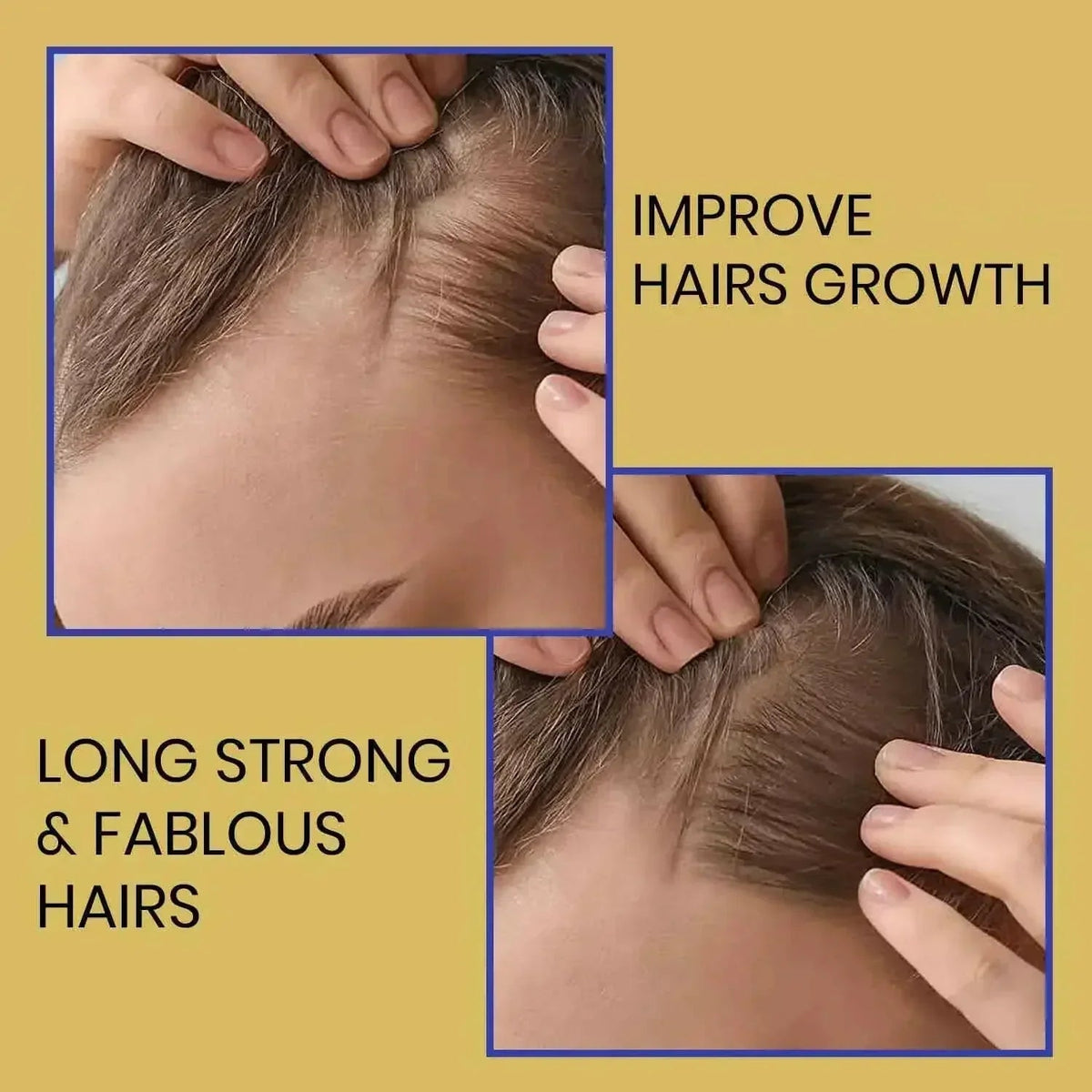 Biotin Shampoo for Thicker-Looking Hair (473ml)